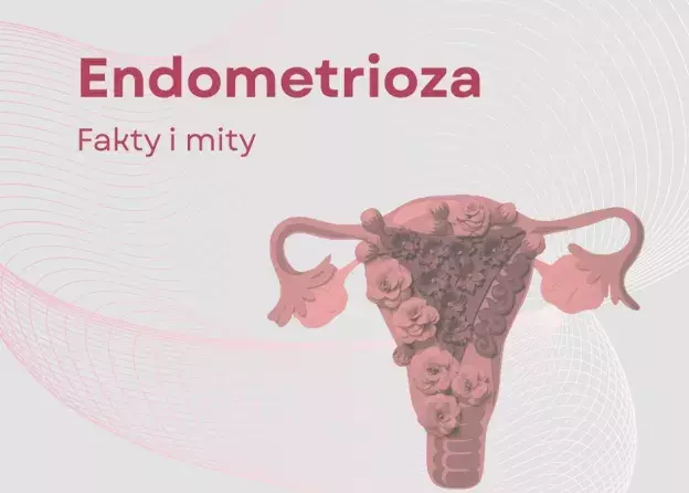 Endometrioza: fakty i mity - rozpoczynamy cykl warsztatów już 1 grudnia!